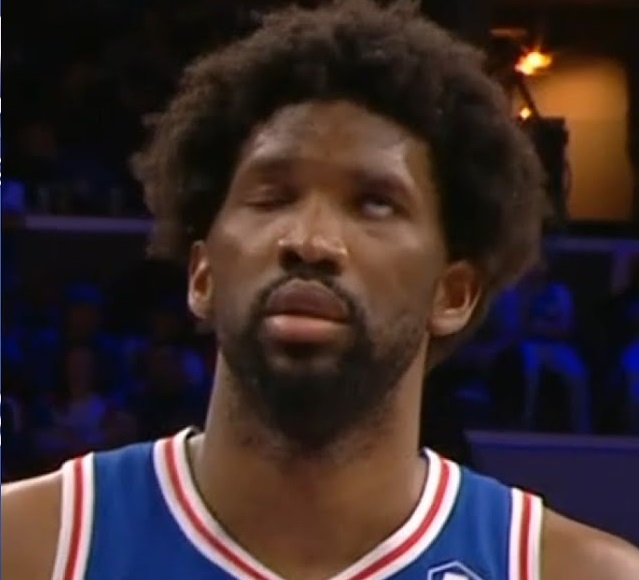 Joel Embiid正患上貝爾氏麻痹症，左邊臉癱瘓無法眨眼 | NBA地域 | 籃球地帶 - FanPiece